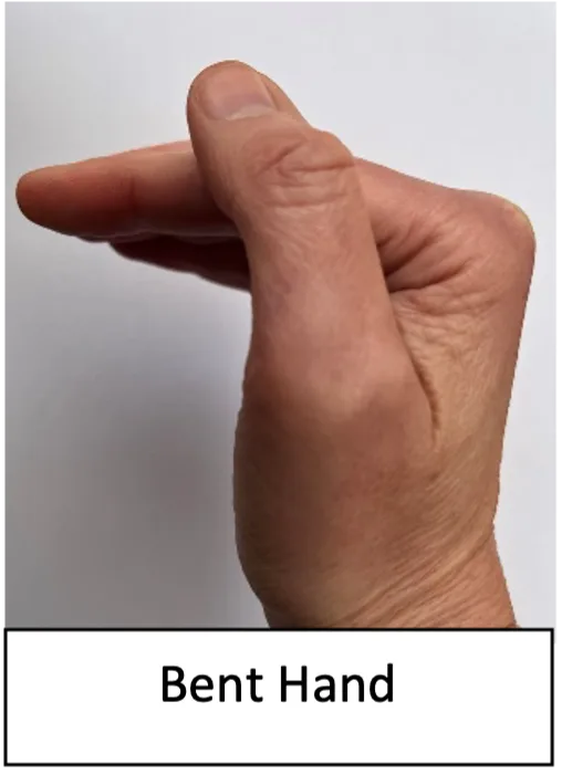Bent_hand